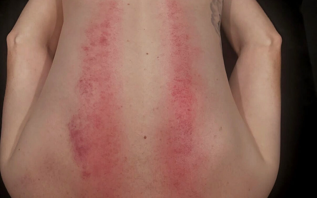 deep tissue massage for athletes – hall of pain • Anthony Garcia, Massage Therapist